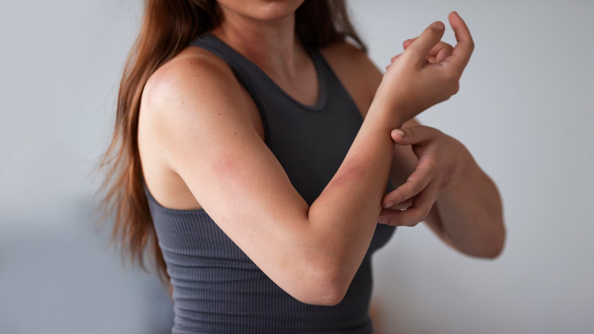 psoriasis symptoms in women