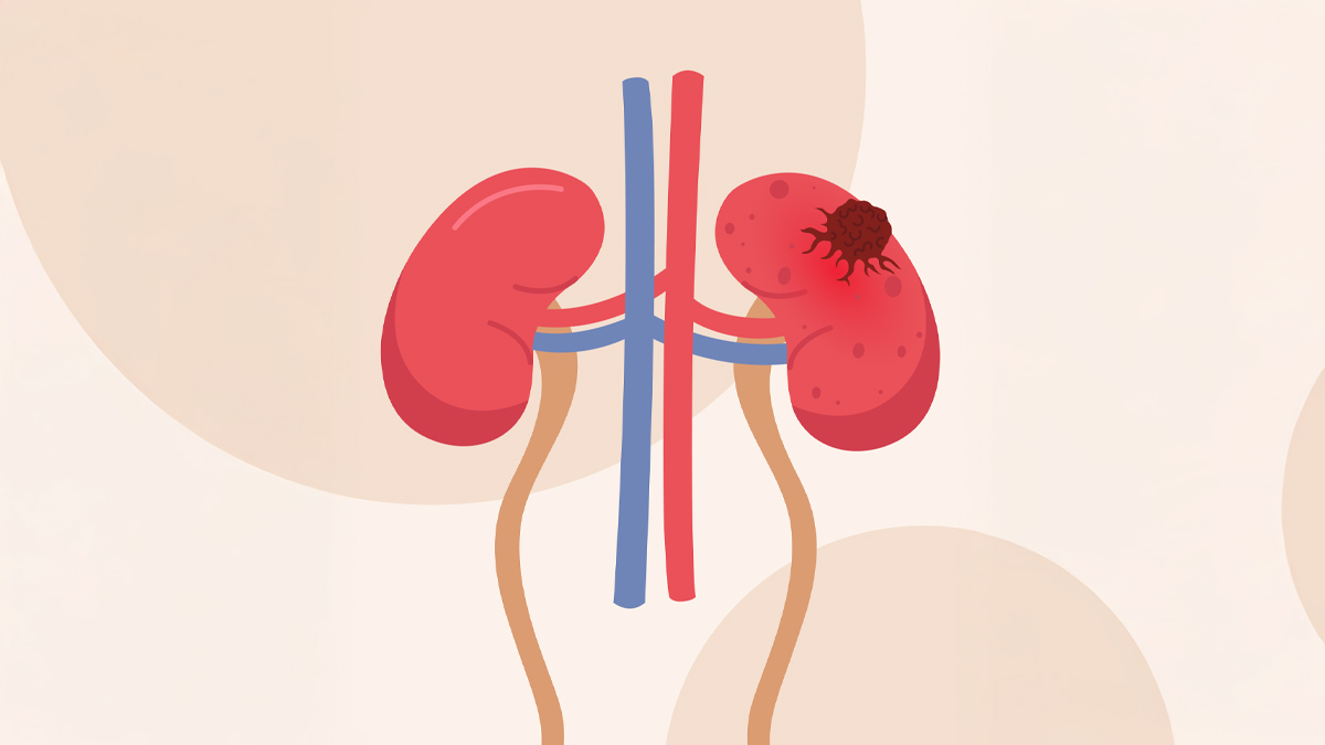 2 - 2025-06-25T113750.486