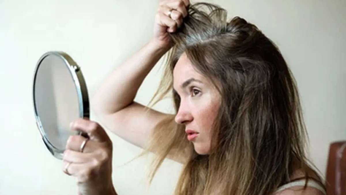 Study Reveals Gen-Z is Greying Faster, Doctor Explains Why