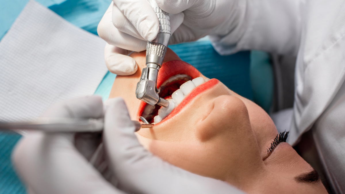 benefits of tooth scaling 3 - 2025-06-26T150240.973