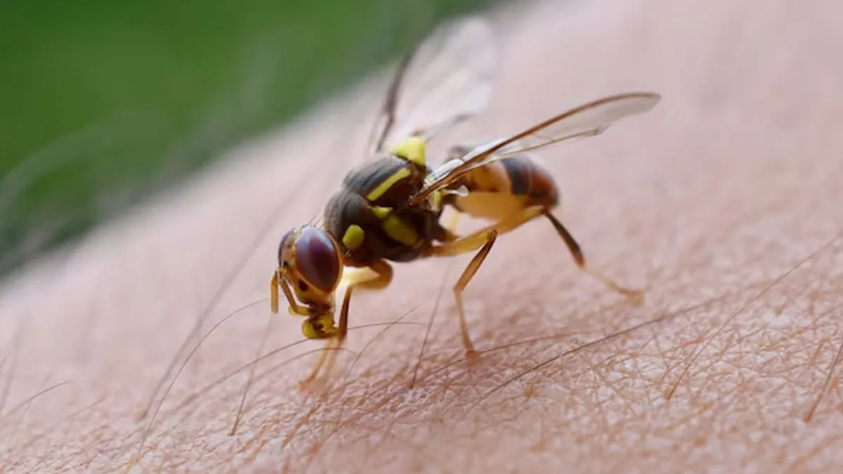 Don't Take A Bee Sting Lightly; Here's Why And Steps To Take Immediately