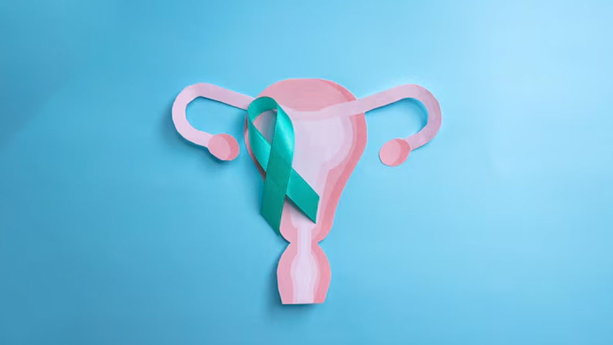 ovarian-cancer