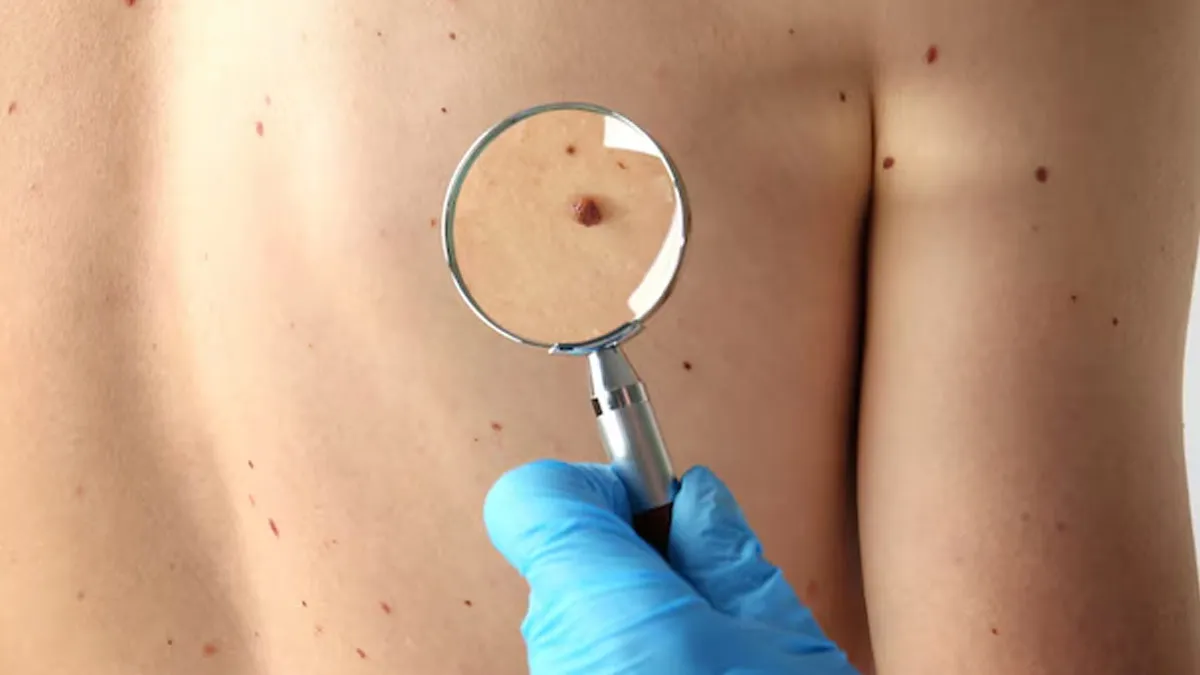 Obesity And Skin Health: 7 Conditions To Watch Out For