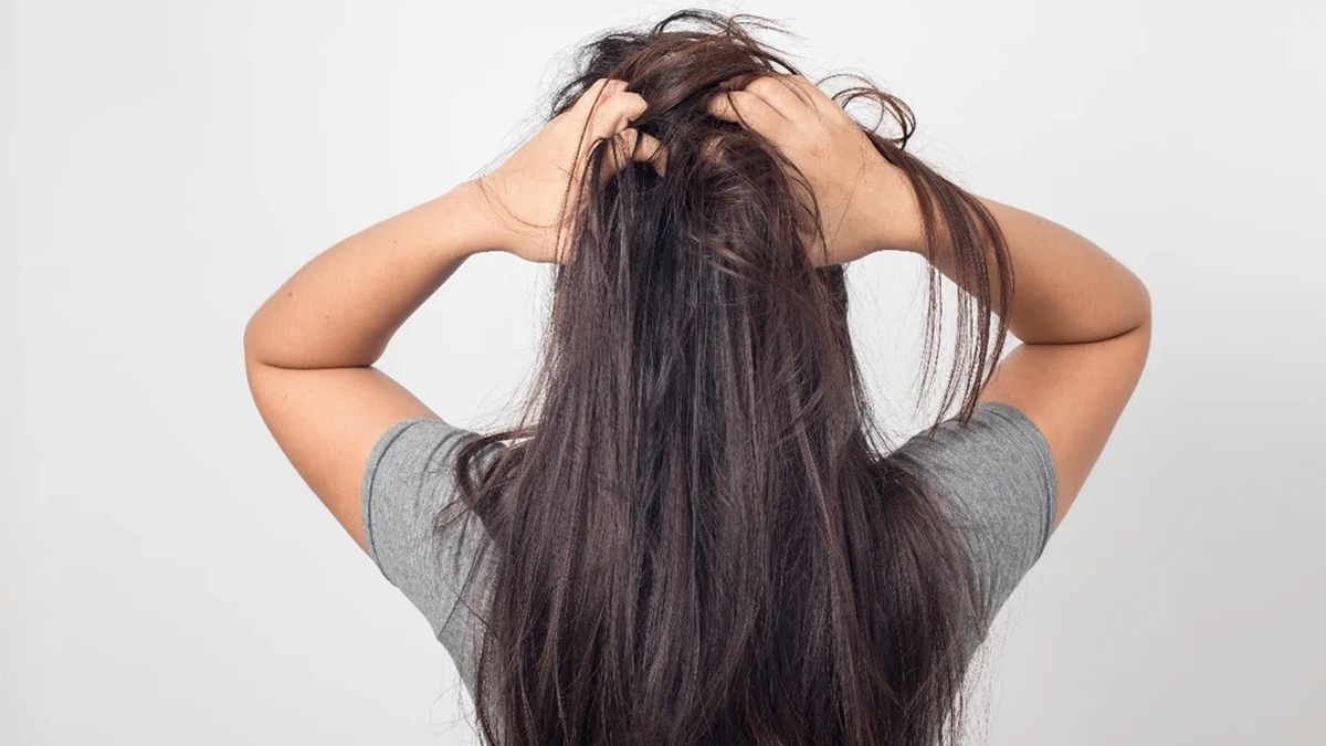 Trichotillomania 2 - 2025-07-01T114521.857