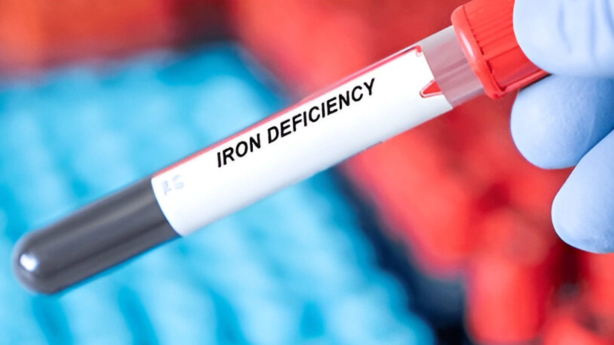 iron-deficiency-anaemia