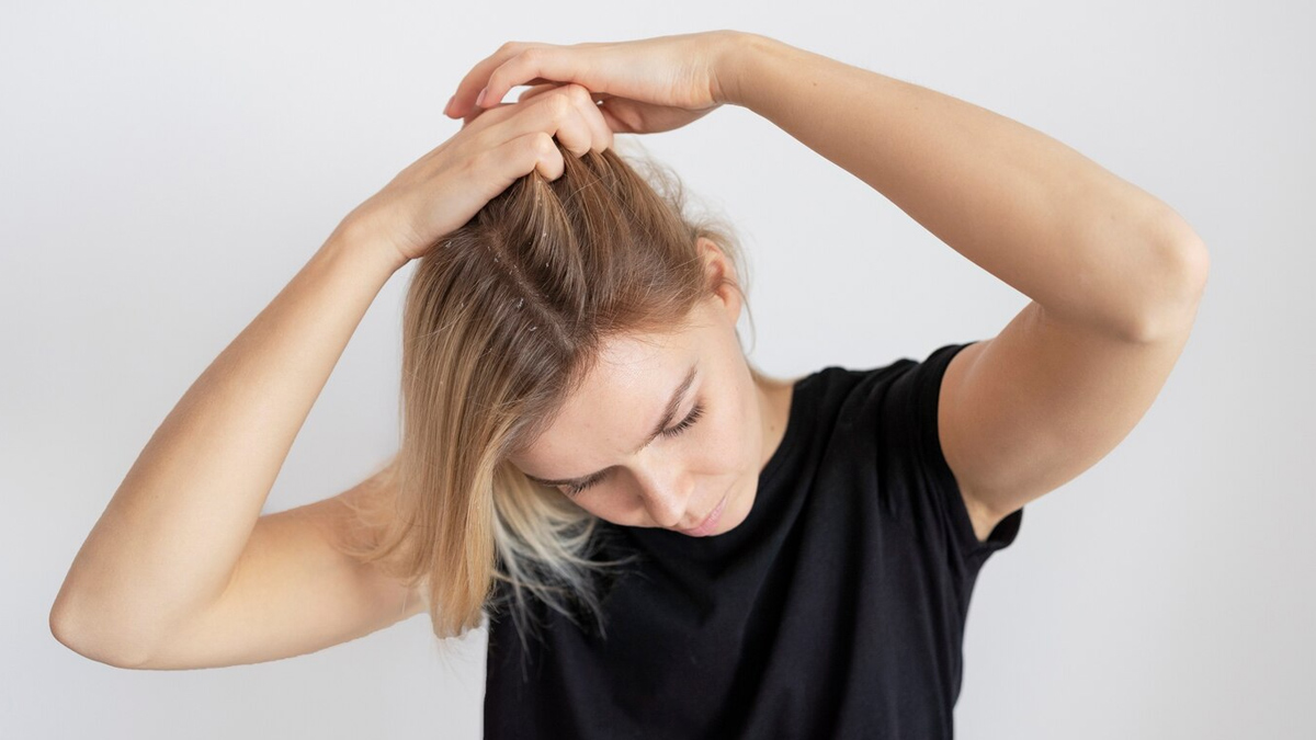 itchy-scalp