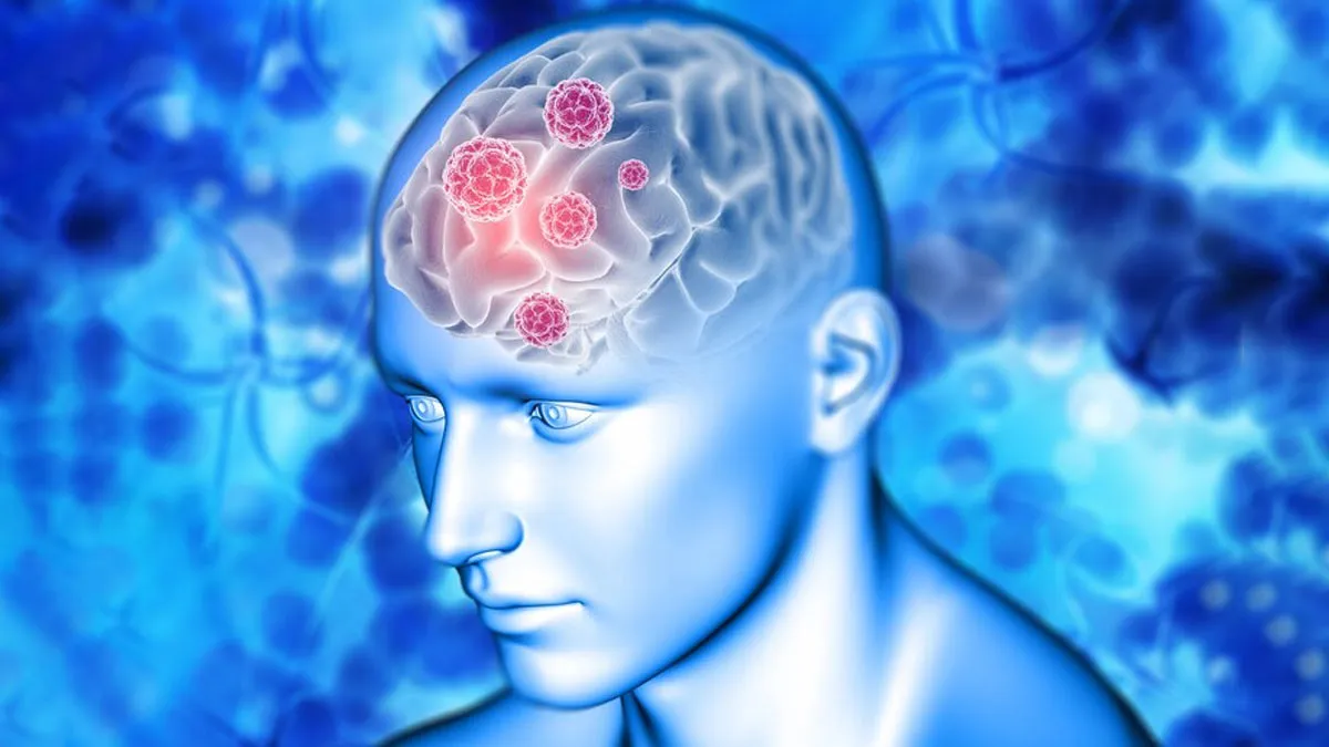 What Causes Blood Clots To Form In The Brain?