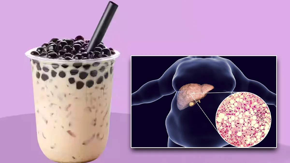 Is Boba Tea Habit Putting You at Risk for Cirrhosis? Experts Warn of Fatty Liver Progression