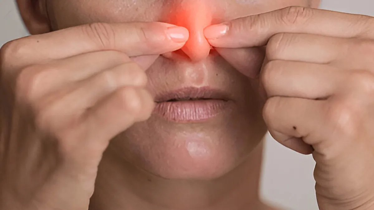 The Hidden Dangers Of Nasal Polyps: Why A Stuffy Nose Isn't Just A Cold?