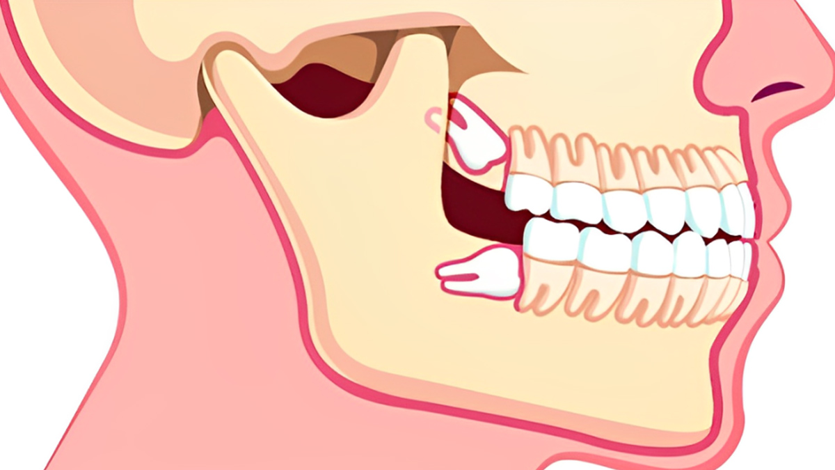 what affects jaw size 1 - 2025-07-03T105757.734