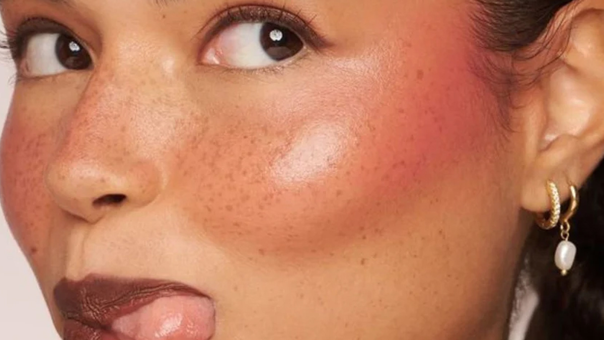 freckles on face 1 - 2025-07-03T132601.363