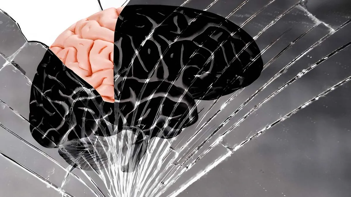 Neuroplasticity After Stroke: How The Brain Rewires And Why Rehab Timing Matters