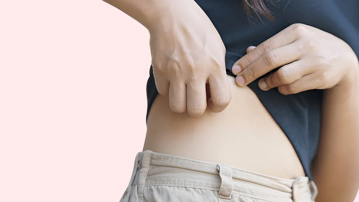 Sweat Rash On Your Waistband Line? Natural Fixes Without Talcum Powder