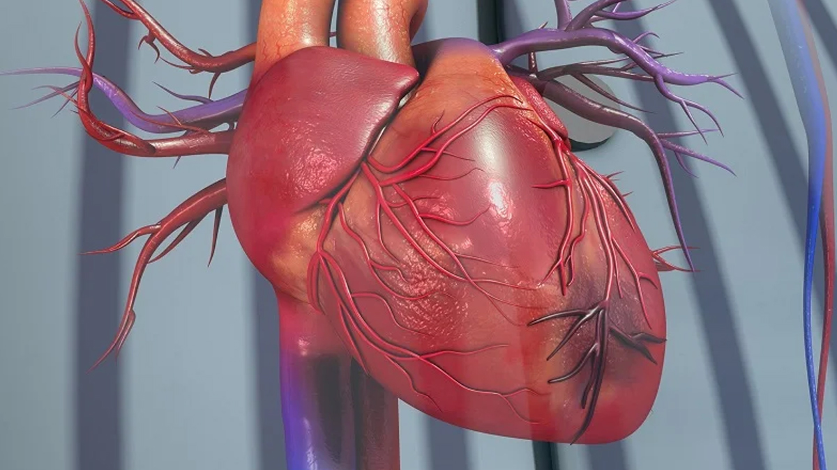 Myocardial Infarction 1 - 2025-07-07T154007.539