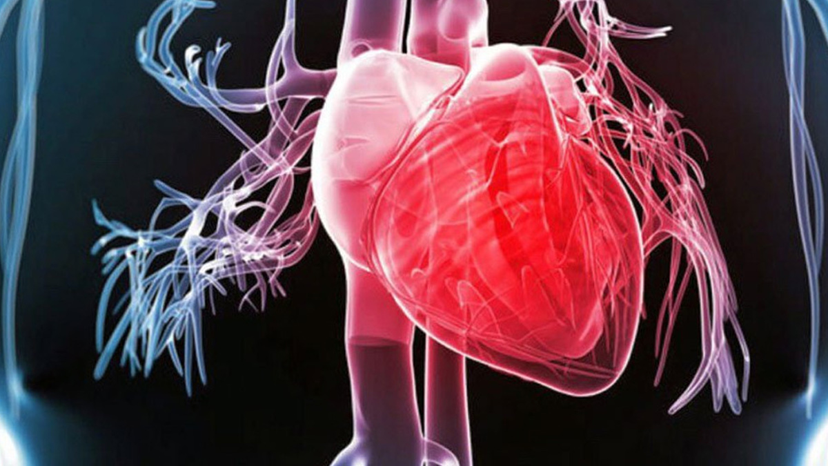 Myocardial Infarction symptoms 3 - 2025-07-07T154006.321