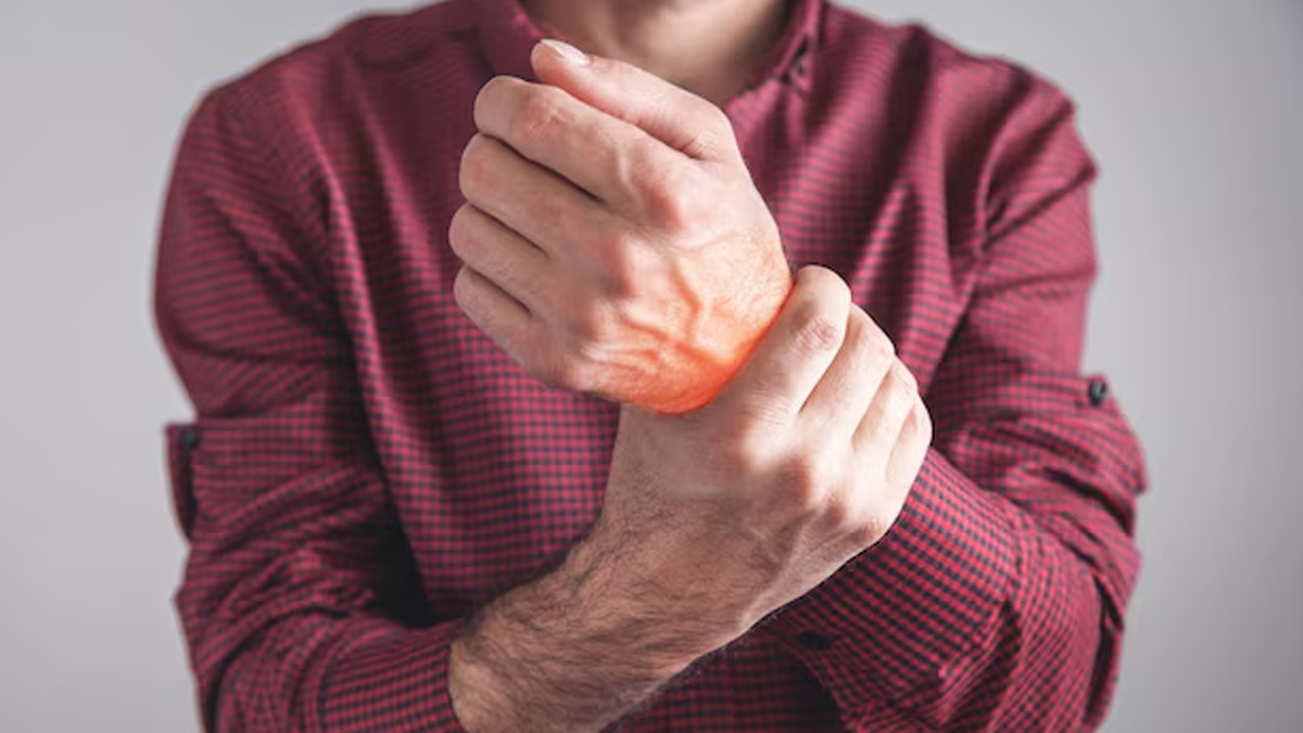 Rheumatoid-Arthritis