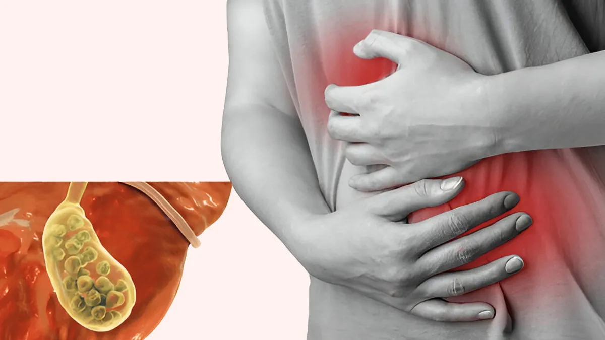 Gallbladder Stones Often Start With Digestive Discomfort: Symptoms To Watch Out For