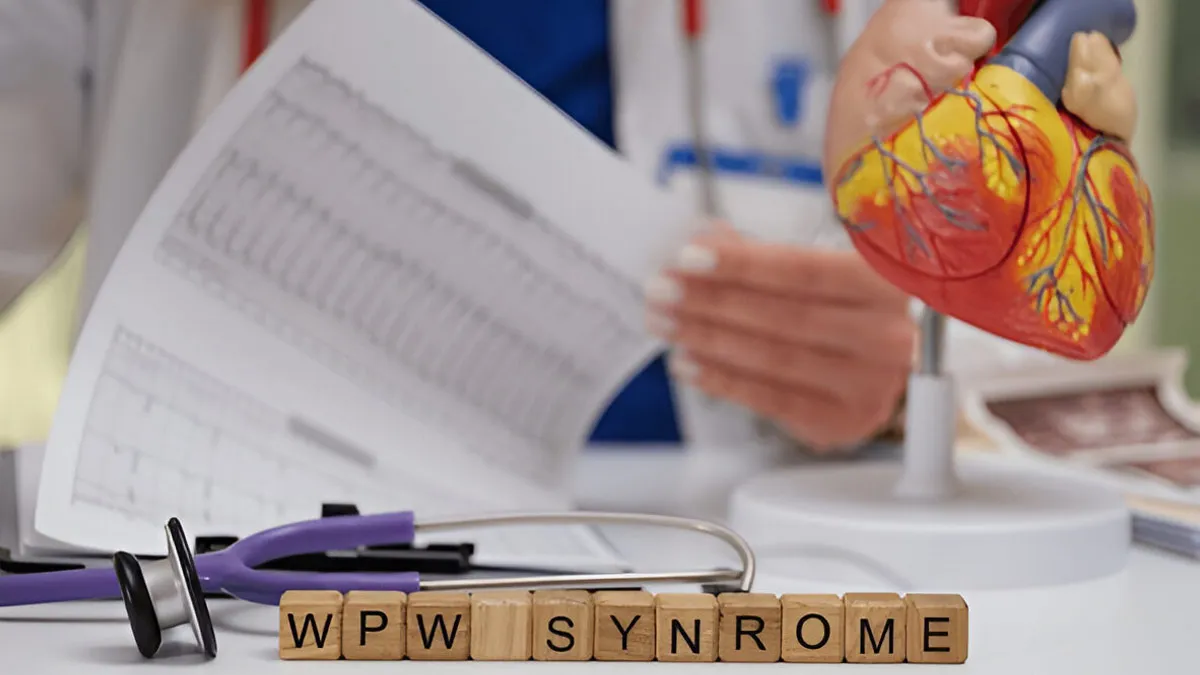 Wolff-Parkinson-White (WPW) Syndrome: From Causes To Symptoms, All You Need To Know About This Arrhythmia