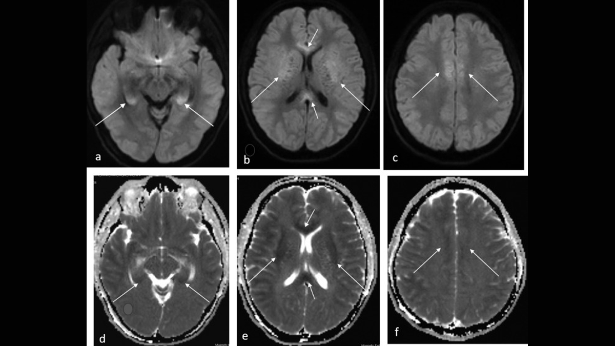 2 - 2025-07-09T150425.161