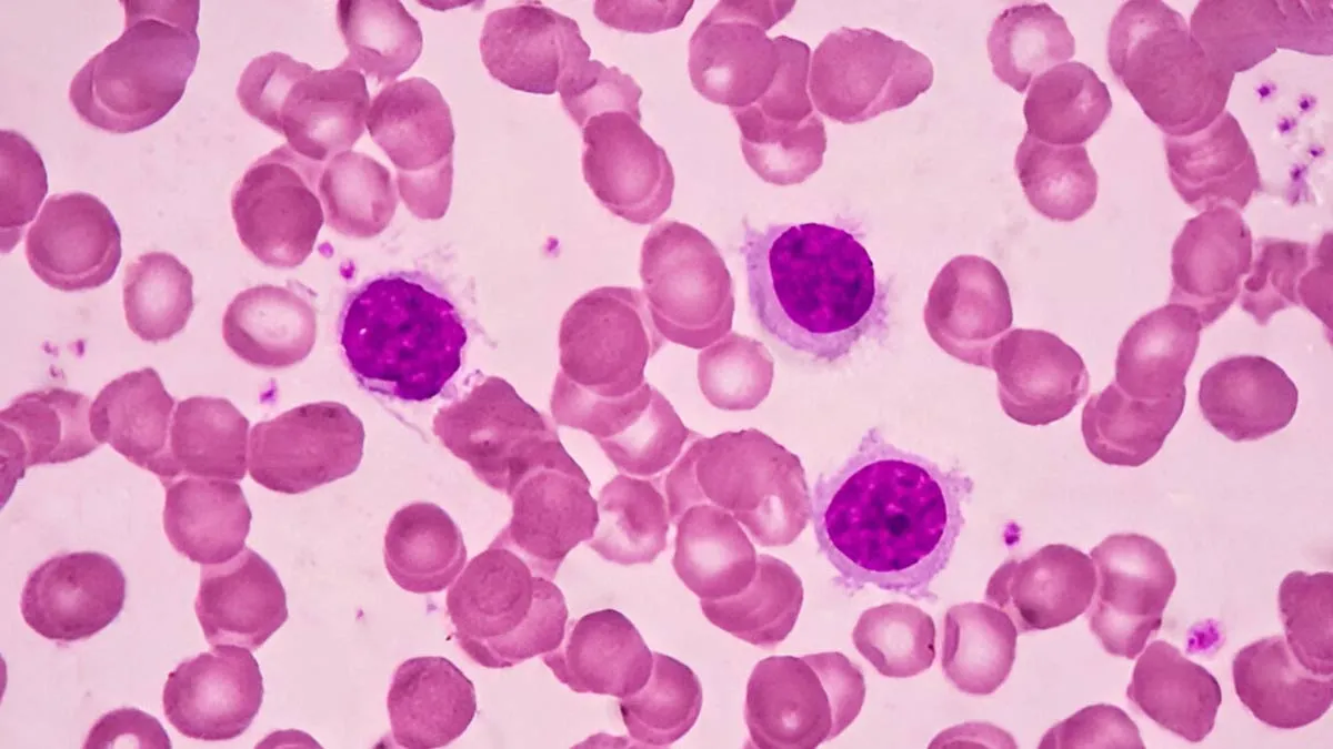 The Quiet Emergency: Why Rare Cancers In India Deserve Urgent Attention