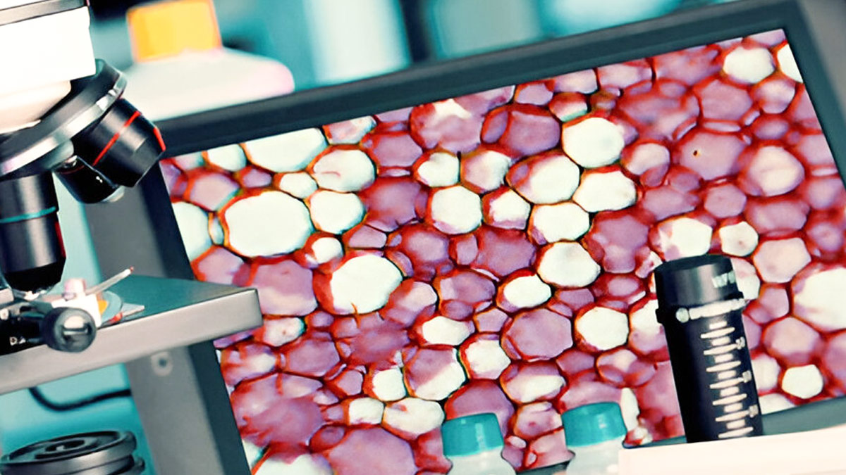cancer-biopsy