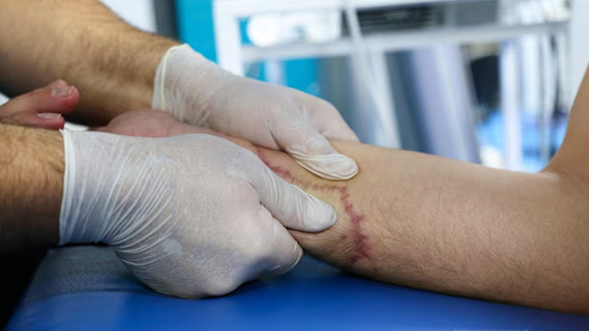 Can Past Injuries Cause Skin Cancer? Expert
