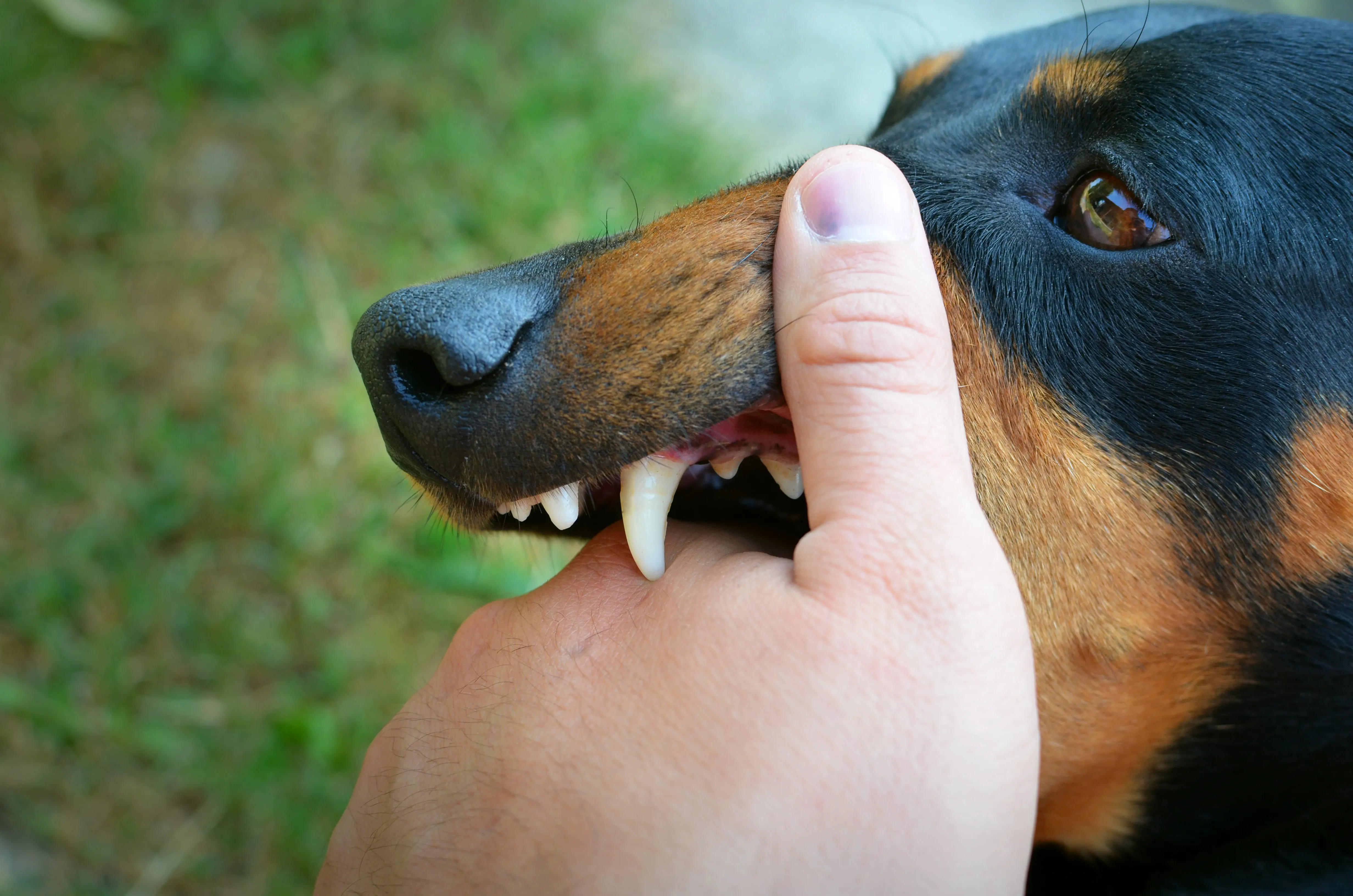 Month After Dog Bite, Krishnagiri Youth Dies of Rabies; Here's What Went Wrong!