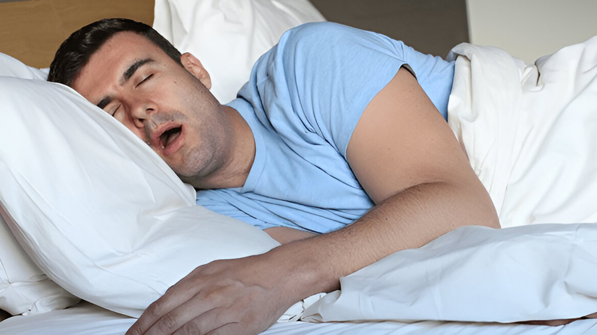 obstructive-sleep-apnoea