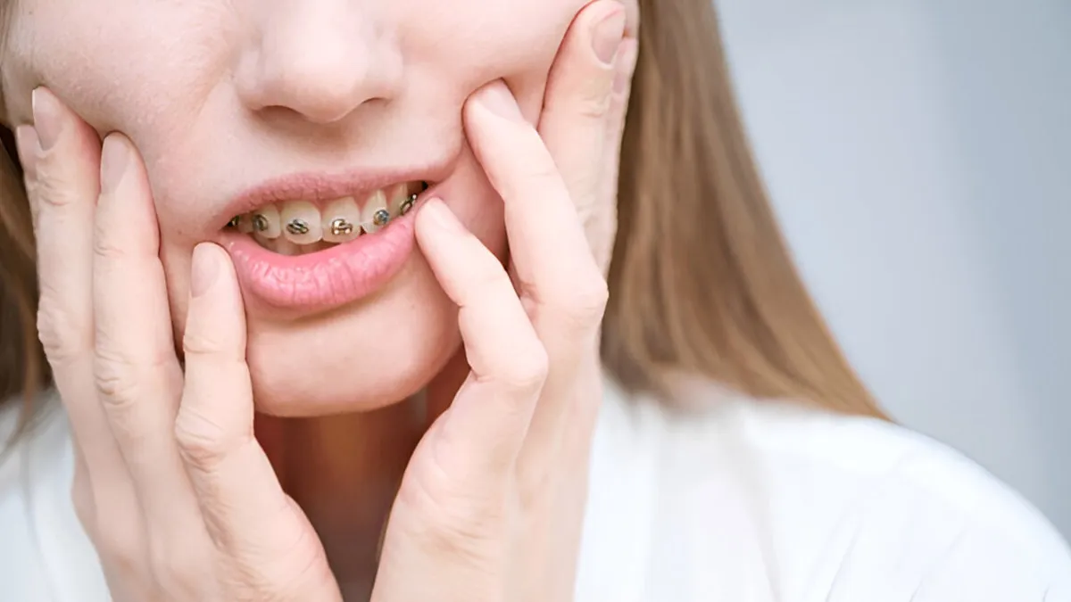 Why You Keep Biting The Inside Of Your Cheek And How To Stop?