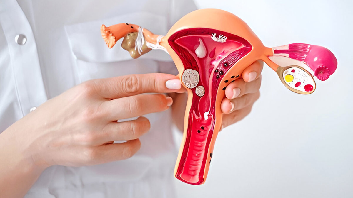 Not Just Hormones: How Blood Pressure, Vitamin D, and Lifestyle Impact Fibroid Risk