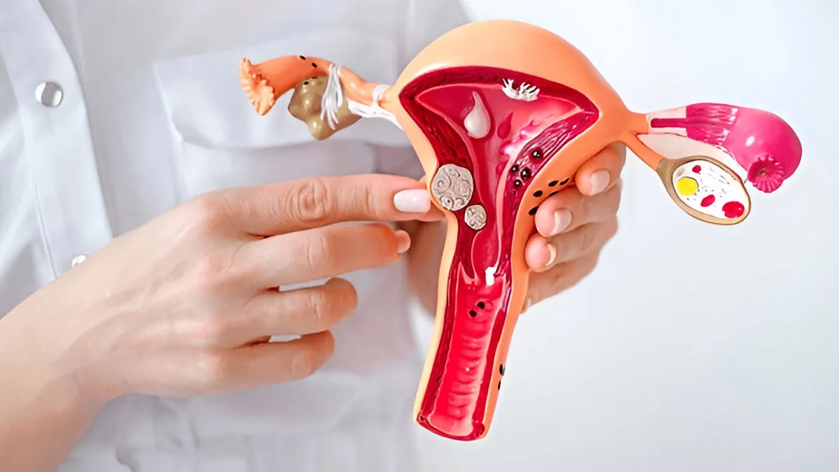 Not Just Hormones: How Blood Pressure, Vitamin D, and Lifestyle Impact Fibroid Risk