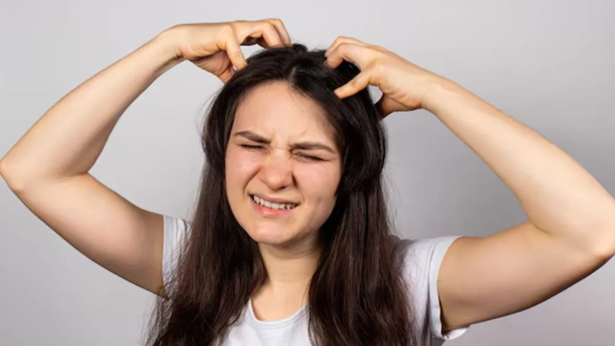 Your Hairline is Itching But There’s No Dandruff? Here’s What Else It Could Be