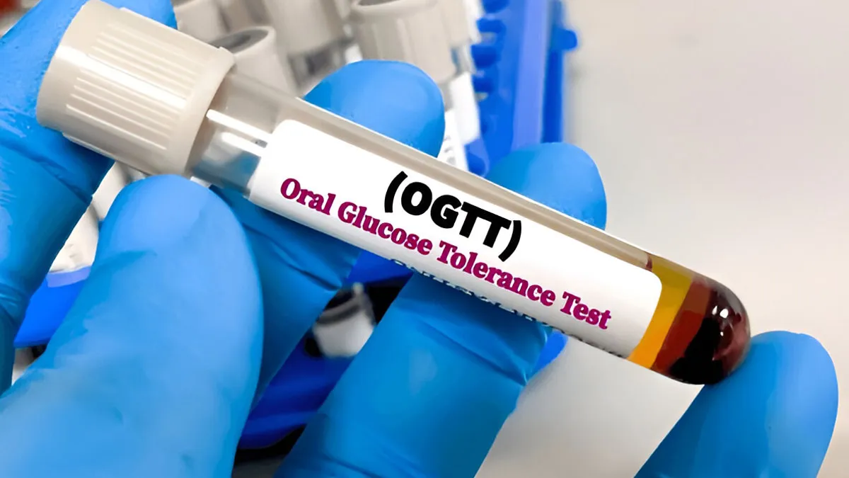 Oral Glucose Tolerance Test: How Does This 3-Step Test Work To Detect Diabetes Early?