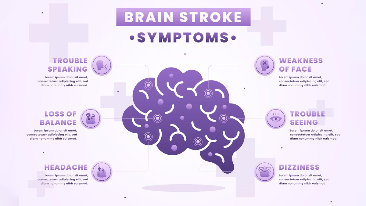 brain stroke symptoms