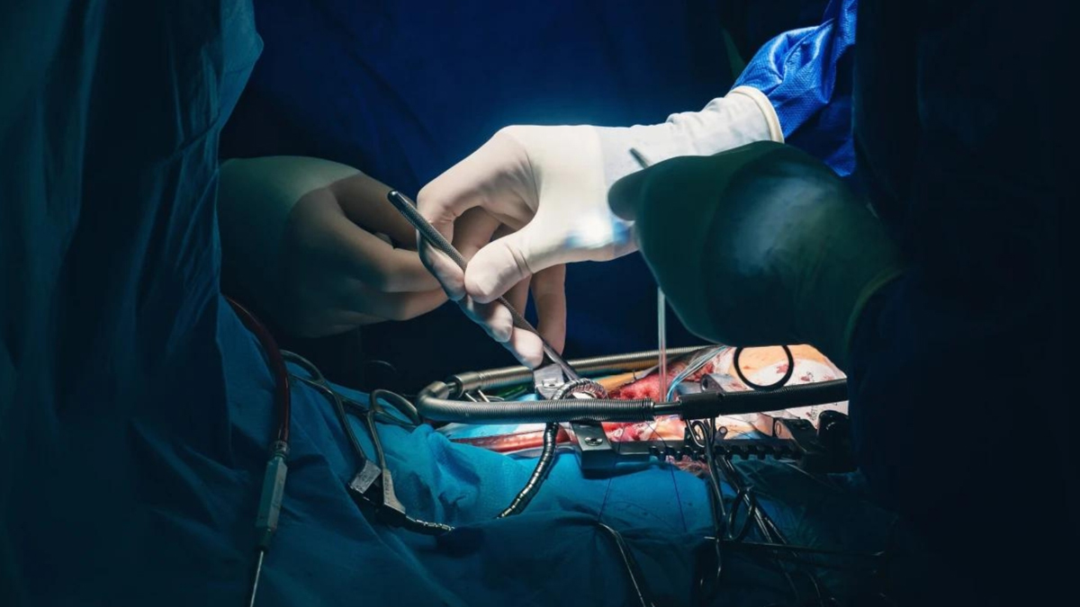 is Quintuple Bypass Surgery serious 2 - 2025-07-23T081723.121