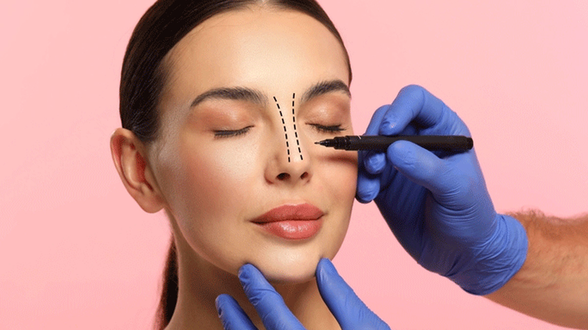 who gets Rhinoplasty 2 - 2025-07-23T123027.444