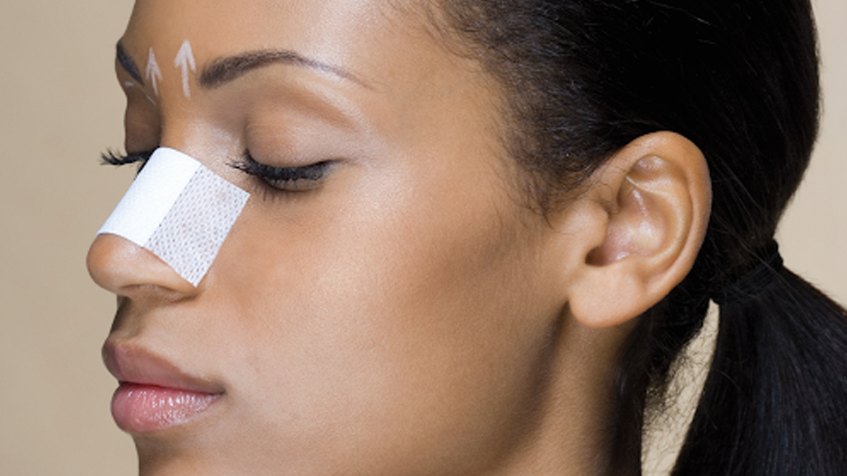 Rhinoplasty nose job risks 4 - 2025-07-23T123029.128