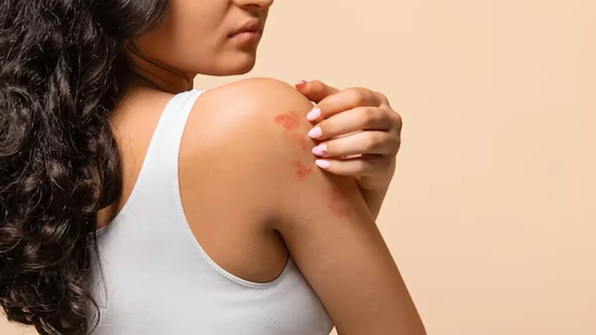 Should You be Worried About Mercury In Your Skin Whitening Products?