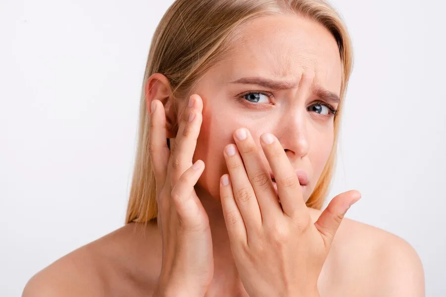 What Is Skin Purging and How Do You Know It's Not a Breakout