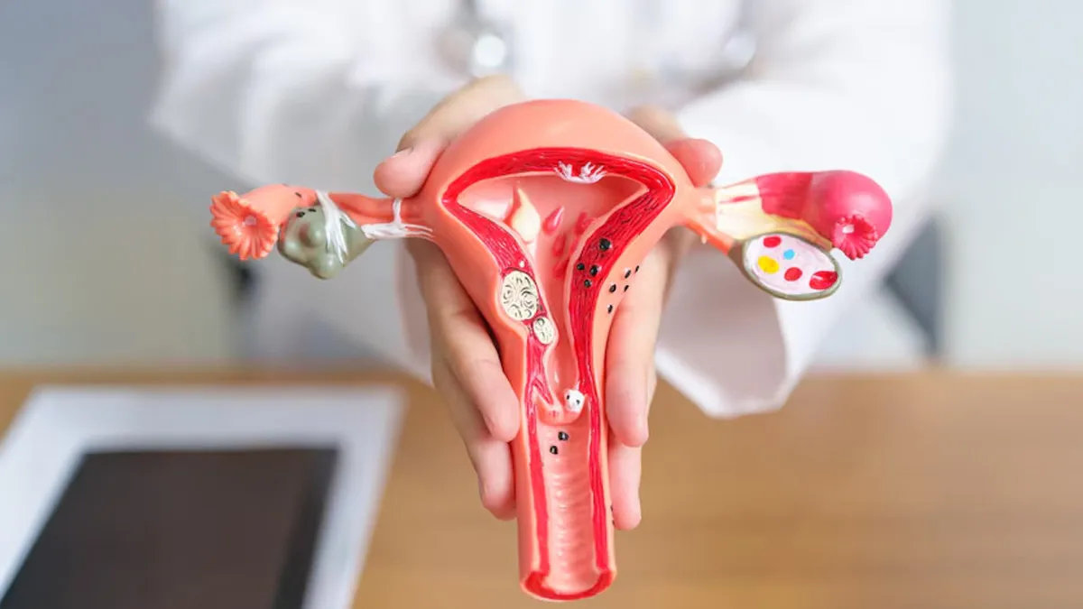 World IVF Day 2025: Do Uterine Fibroids Affect Implantation?