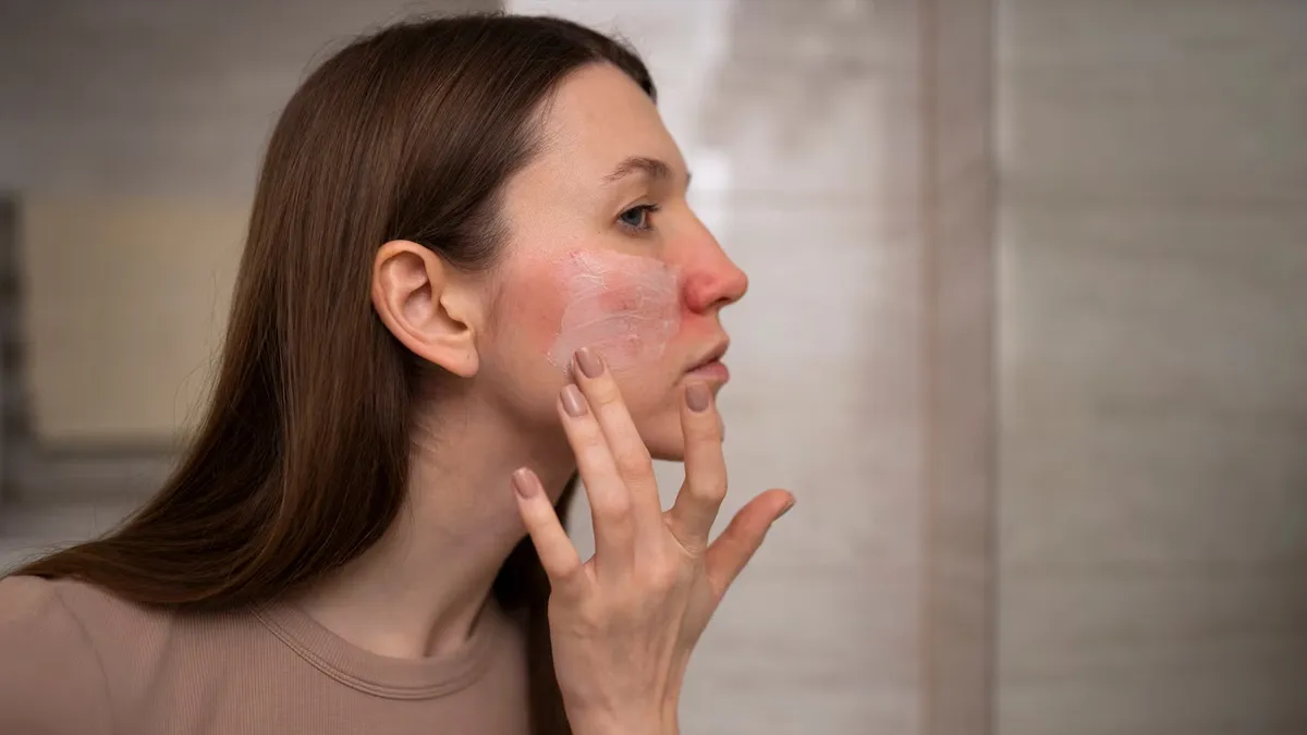 Monsoon Skin Problems: Homoeopathic Solutions That Work, Doctor Tells