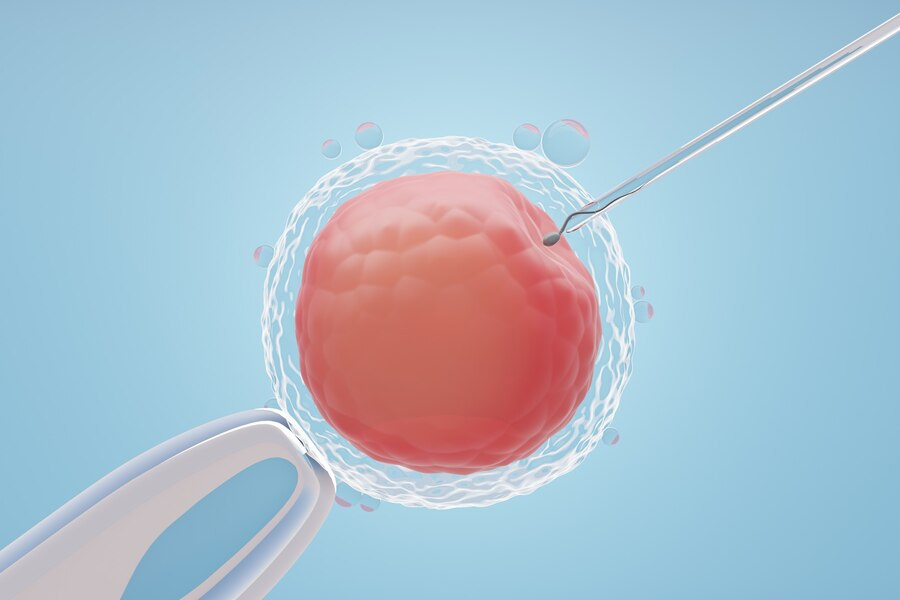 1-IVF