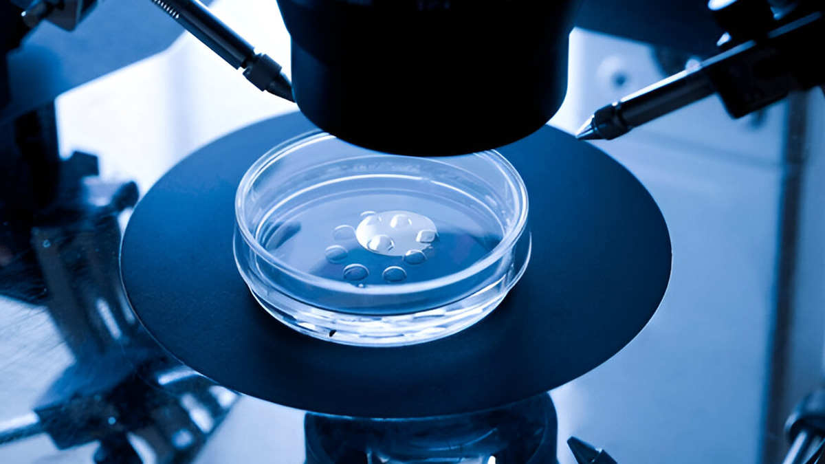 IVF