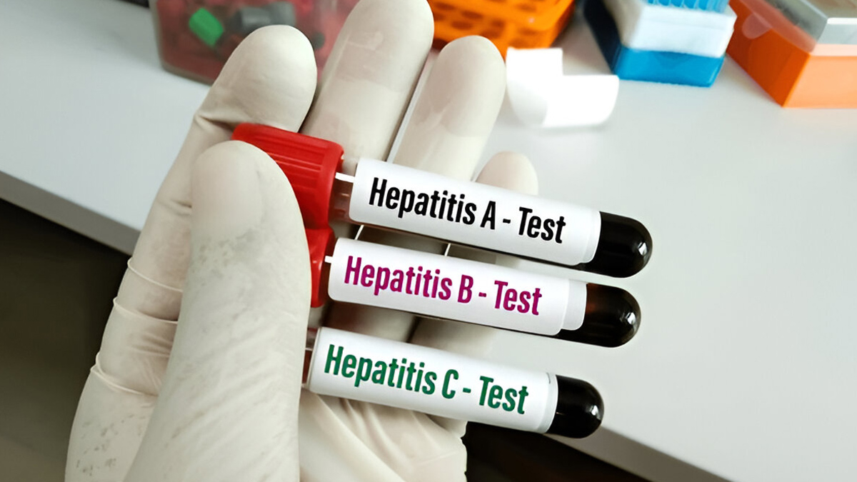 hepatitis-testing