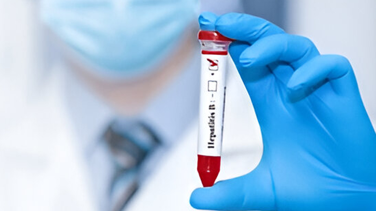 hepatitis-treatment