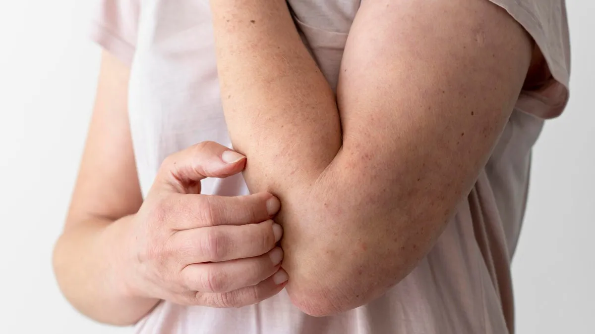 Tips For Managing Skin Rashes Triggered By Damp Clothes