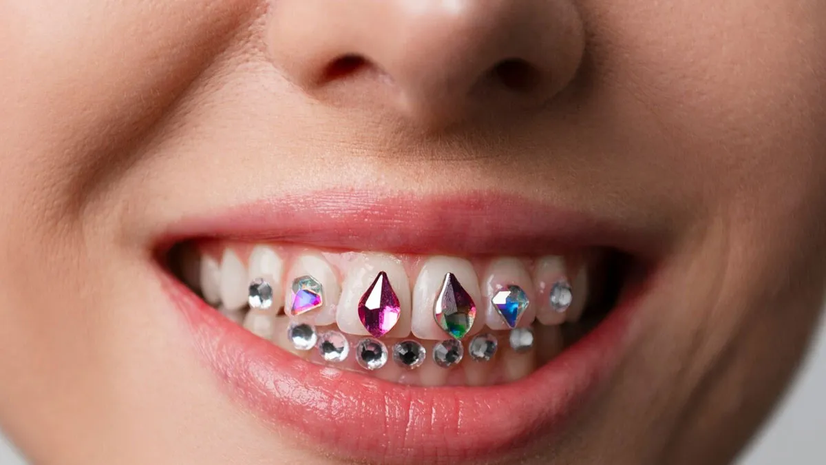 Ever Heard Of Tooth Gems? Know What It Is And Are They Safe Or Not
