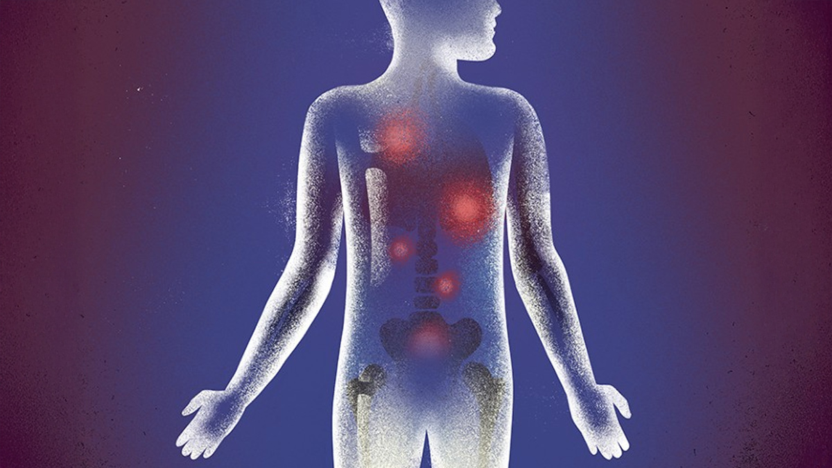 Ryan Sandberg death cause Prostate Cancer  1 - 2025-07-29T100550.108