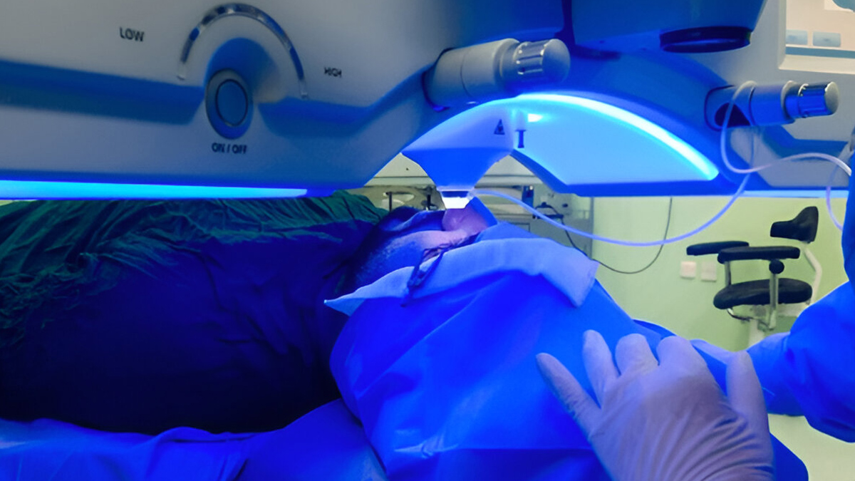 Corneal-Collagen-Cross-linking