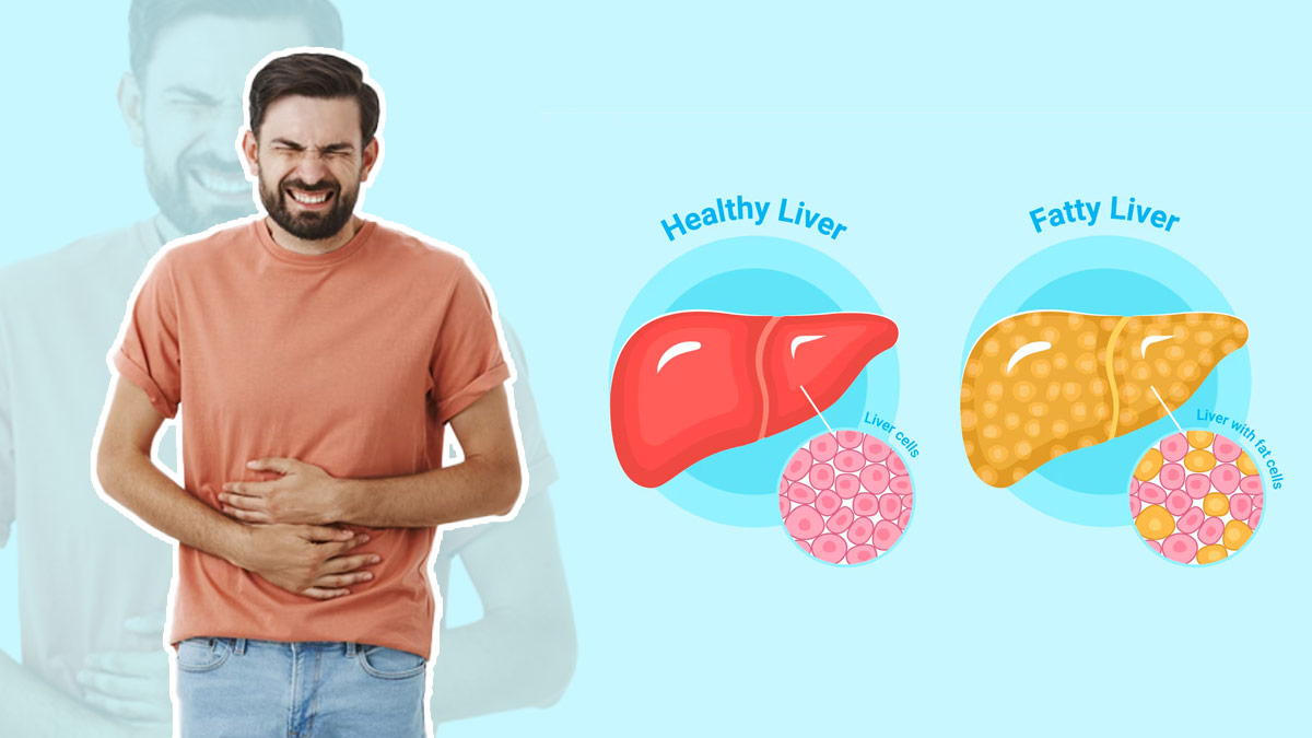 Doctor Lists 5 Diet Mistakes that Can Worsen Fatty Liver